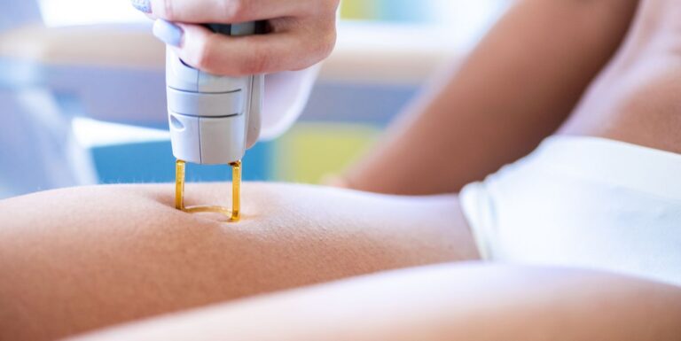 Know Everything About Laser Body Hair Removal Treatment